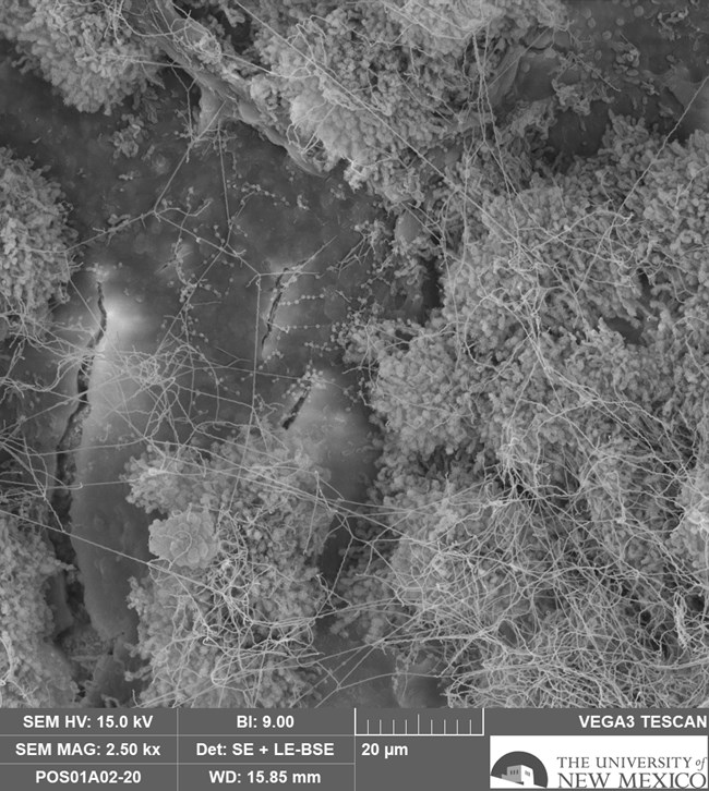 gray and white image showing thick tangle of bacteria with stringy appendages