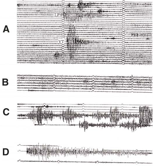 Volcano GeoMonitoring Figure 6 Figure 6 (description follows)