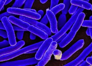 E. coli Image of E. coli through a microscope