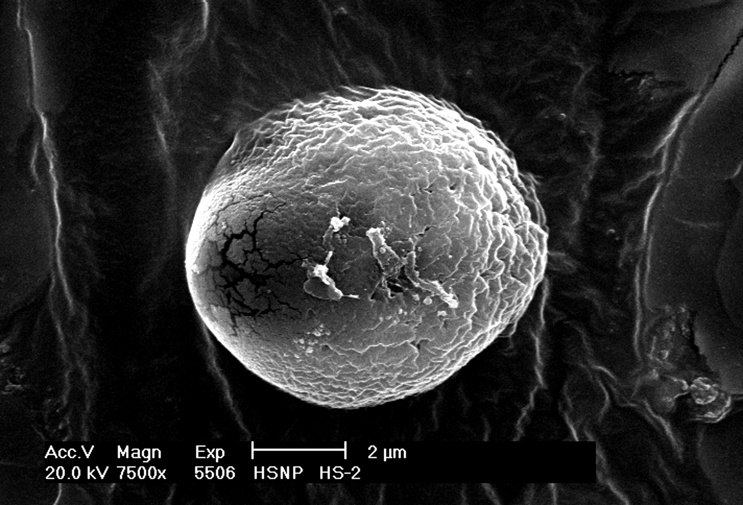 Microscopic Pine Pollen - Rocky Mountain National Park (U.S. National Park  Service)