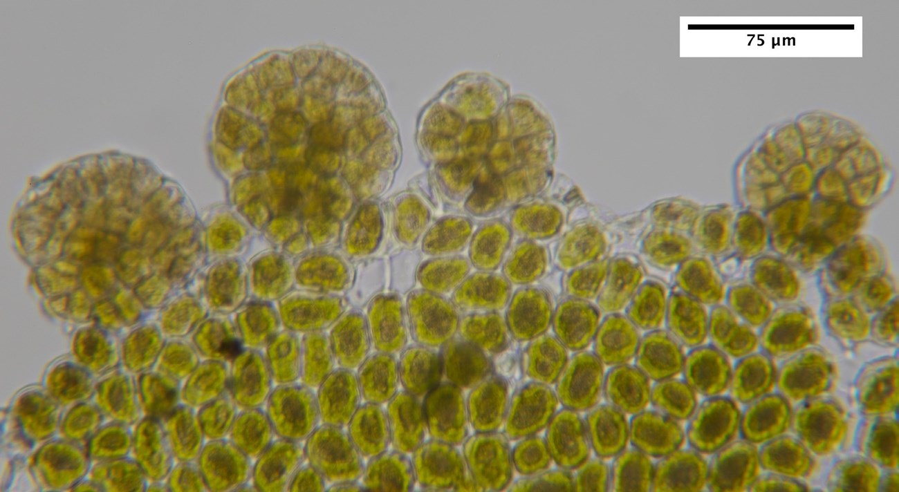 Microscopic view of olive green clusters of reproductive cells located on the margin of a Radula complanata.
