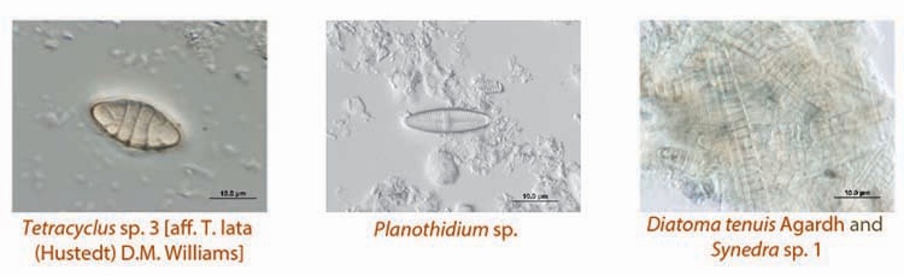 Picture15 3 photo micrographs of diatoms,